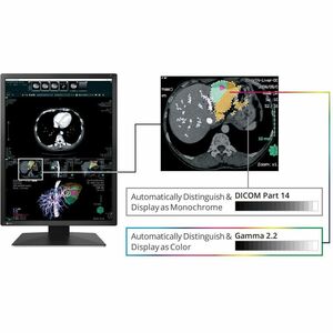 EIZO RadiForce MX217-BK 21" Class UXGA LED Monitor - 3:4 - Black - 21.3" Viewable - In-plane Switching (IPS) Technology - 
