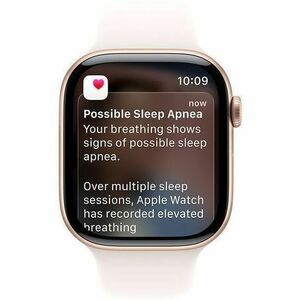 Apple Watch Series 11 Smartwatch - 46 mm Case Height - 39 mm Case Width - Rose Gold Case Color - Light Blush Band Color - 