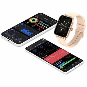 Carneo Versa HR+ Smart Watch - Rose Gold Body Color - Tempered Glass Body Material - Pedometer - Phone, Text Messaging, Mu