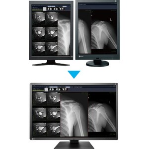 6MP COLOUR 30IN EIZO RADIFORCE RX660 WITH AR COATING LED SELFQC