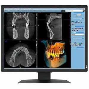 EIZO RadiForce MX217-SB 21" Class UXGA LED Monitor - 3:4 - Black - 53.3 cm (21") Viewable - In-plane Switching (IPS) Techn