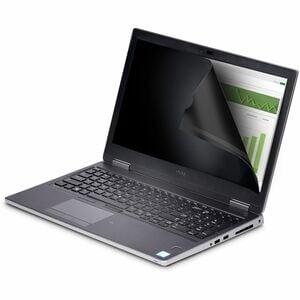 StarTech.com Anti-glare Privacy Screen Filter - 1 - For 40.6 cm (16") Notebook - 16:10 - Blue Light Reduction