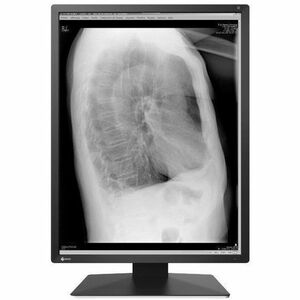 EIZO RadiForce RX270 21" Class WUXGA LED Monitor - 3:4 - Black, White - 54.1 cm (21.3") Viewable - In-plane Switching (IPS