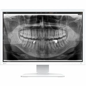 EIZO RadiForce MX243W-DT 24" Class WUXGA LED Monitor - 16:10 - White - 61.2 cm (24.1") Viewable - In-plane Switching (IPS)