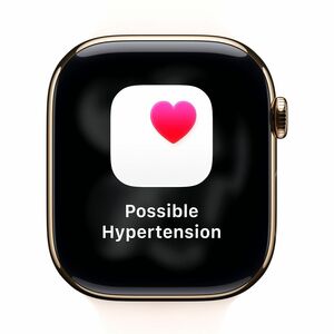 Apple Watch SE 3 Smart Watch - 40 mm Case Height - 34 mm Case Width - Starlight Case Color - Starlight Band Color - Alumin