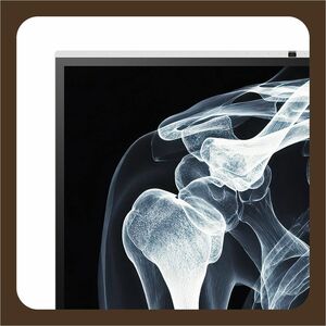 BenQ Board CP5505 1397 mm 4K UHD LCD Collaboration Display - ARM Cortex A78 + A55 - 16 GB - Projected Capacitive - Touchsc