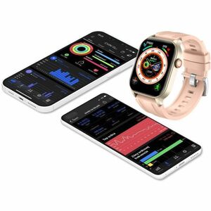 Carneo Ventura HR+ Smart Watch - 11 mm Case Thickness - Gold, Golden, Yellow Body Color - Beige Band Color - Mineral Glass