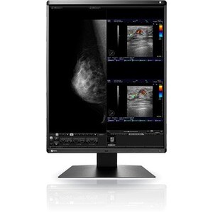 EIZO RadiForce RX560-MD 21" Class QSXGA LCD Monitor - 5:4 - Black, White - 54.1 cm (21.3") Viewable - In-plane Switching (