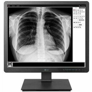 LG 19HK312C-B 19" Class SXGA LCD Monitor - 5:4 - Black - 19" Viewable - In-plane Switching (IPS) Technology - 1280 x 1024 