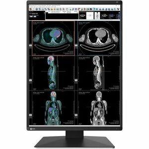 EIZO RadiForce RX370-AR 21" Class QXGA LED Monitor - 54.1 cm (21.3") Viewable - In-plane Switching (IPS) Technology - LED 