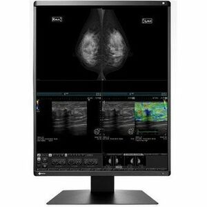 EIZO RadiForce RX570 21" Class QSXGA LED Monitor - 4:5 - Black - 21.3" Viewable - In-plane Switching (IPS) Technology - LE