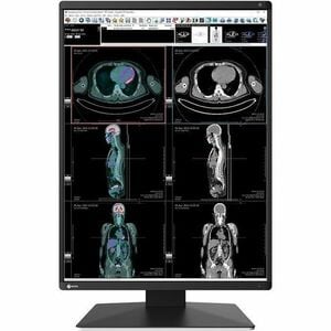 EIZO RadiForce RX370-AR 21" Class QXGA LED Monitor - 54.1 cm (21.3") Viewable - In-plane Switching (IPS) Technology - LED 
