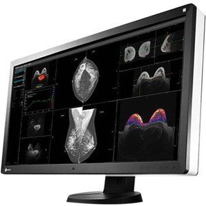 6MP COLOUR 30IN EIZO RADIFORCE RX660 WITH AR COATING LED SELFQC