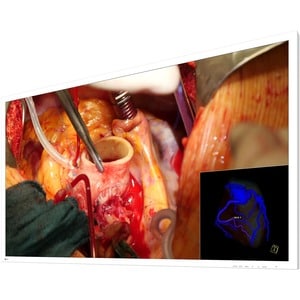 EIZO CuratOR EX5841 58" Class 4K UHD LCD Monitor - 16:9 - White - 57.5" Viewable - LED Backlight - 3840 x 2160 - 1.07 Bill