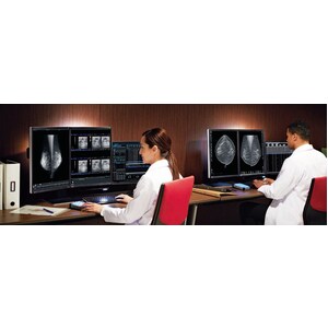 EIZO RadiForce RX560-MD 21" Class QSXGA LCD Monitor - 5:4 - Black, White - 54.1 cm (21.3") Viewable - In-plane Switching (