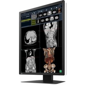 EIZO RadiForce RX270 21" Class WUXGA LED Monitor - 3:4 - Black, White - 54.1 cm (21.3") Viewable - In-plane Switching (IPS