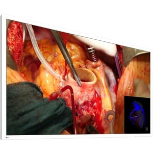 EIZO CuratOR EX5841 58" Class 4K UHD LCD Monitor - 16:9 - White - 57.5" Viewable - LED Backlight - 3840 x 2160 - 1.07 Bill