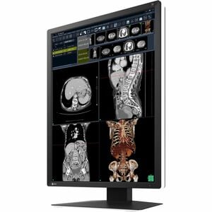 EIZO RadiForce RX270 21" Class WUXGA LED Monitor - 3:4 - Black, White - 54.1 cm (21.3") Viewable - In-plane Switching (IPS