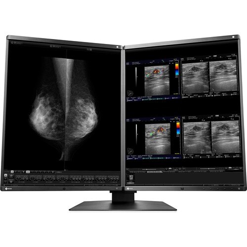 EIZO RadiForce RX560-MD 21" Class QSXGA LCD Monitor - 5:4 - Black, White - 54.1 cm (21.3") Viewable - In-plane Switching (