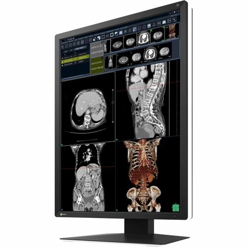 EIZO RadiForce RX270 21" Class WUXGA LED Monitor - 3:4 - Black, White - 54.1 cm (21.3") Viewable - In-plane Switching (IPS