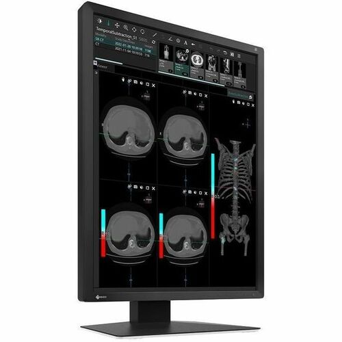 EIZO RadiForce MX217-BK 21" Class UXGA LED Monitor - 3:4 - Black - 21.3" Viewable - In-plane Switching (IPS) Technology - 