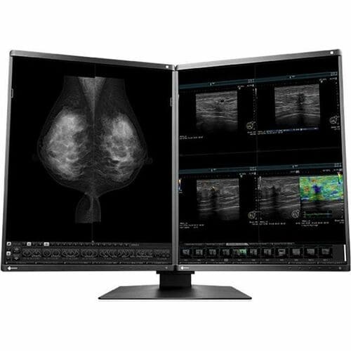 EIZO RadiForce RX570 21" Class QSXGA LED Monitor - 4:5 - Black - 21.3" Viewable - In-plane Switching (IPS) Technology - LE